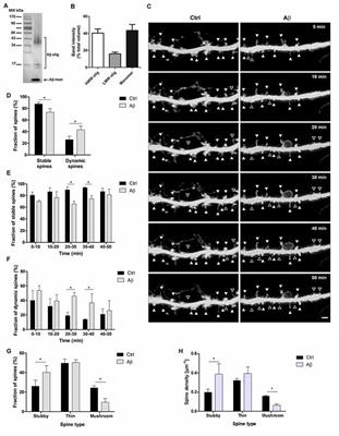 Early Effects of Aβ Oligomers on Dendritic Spine Dynamics and Arborization in Hippocampal Neurons